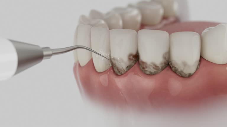 Trusted Root Canal Treatment service in Demarest, NJ - Dentist Open Now